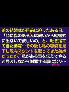 [x]スカッとする話 弟の結婚式が目前に迫ったある日、「顔に傷のある人は醜いから結婚式に出ないで欲しいの」と、吐き捨ててきた弟嫁…その後も私の容姿を ...